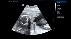 The statistics are compiled based on the data obtained from the national registration department (nrd), state religious department (jain), the department. Tan Clinic Penang 292 G Vantage Point Jalan Lenggong George Town 2021