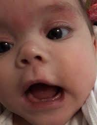 Gerdie… showing where her baby teeth were in the #closeupchallenge