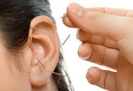 Il existe plusieurs protocoles en acupuncture pour arrêter de fumer, en utilisant deux aiguilles ou plus, insérées sur le nez, l'oreille, le poignet, les tempes. L Auriculotherapie Pour Maigrir Ca Marche Vraiment