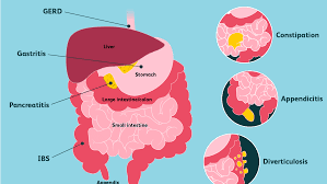 Pain can arise from the colon, urinary system, reproductive organs, vascular system and or stomach wall muscles. Abdominal Pain When To See A Doctor