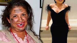 Muy pocos conocen el rostro de la actriz mexicana liliana la famosa comediante bajó de peso y demuestra lo increíble que se ve con una foto que compartió en su cuenta de instagram luciendo un bikini. Todos Pensaron Que La Chupitos Era Horrible Pero Mira Como Luce Realmente Youtube