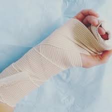 Image result for Radial Gutter Cast