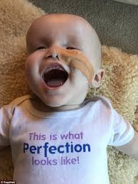 Baby boy born without eyes undergoes operation and is set to get a  prosthetic eye