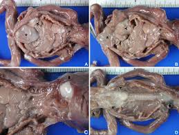 The exact cause of mrkh syndrome remains largely unknown but ongoing research has begun to provide some clues to its mechanism. Multicentric Paraspinal Neuroglial Heterotopia With Mullerian And Renal Agenesis A Variant Of Mayer Rokitansky Kuster Hauser Syndrome Diagnostic Pathology Full Text