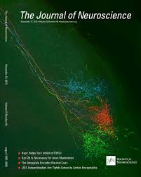 Nathalie holscher video, video syur 20 detik, istri sule video 20detik, video natalie holster dan manajer Cerebral Arterial Pulsation Drives Paravascular Csf Interstitial Fluid Exchange In The Murine Brain Journal Of Neuroscience