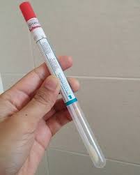 A pap smear, also called a pap test, is a screening performed in your doctor's office (typically by a gynecologist, but nurse practitioners and family doctors also perform them). Dah Tak Seram Takde Muncung Itik Lagi Dah Wanita Kongsi Buat Ujian Pap Smear Sendiri