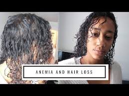 Additionally, a lack of thyroid hormone can. Pin On Hair