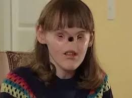 I have a big forehead, small eyes, curved nose, hardly any eyebrow hair and  a long face with fair complexion. I'm 18. Am I pretty?