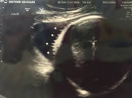 Find ultrasound images of baby girls at various points in pregnancy to help you see what they look like. Ultrasound Photo Appears To Show Crucifix Reassures Mom Of Baby S Health