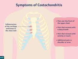 Costochondritis Overview And More