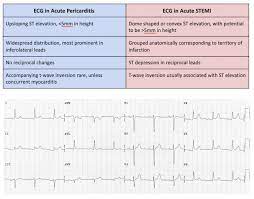 Aşağıdaki iki ekg ber olan hastada perikardit geliştiğinde ne olduğunu göstermektedir: Acute Pericarditis Critical Care Education