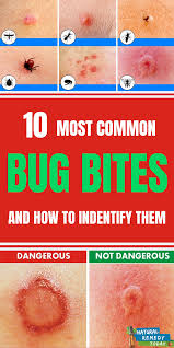 Pin On Remedies Useful Information