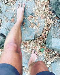 5, purchased the gargantuan tuna for 193 million yen, which is currently worth about $1,780,811, according to the new york post. Jan Tuna S Feet Wikifeet Men