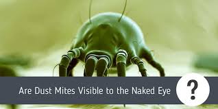 These mites feed on the skin cells. Are Dust Mites Visible To The Naked Eye Pest Control Faq