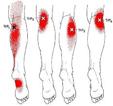 Pin On Baker S Cyst
