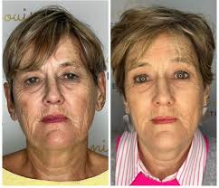 ✨ Transform Your Body & Well-Being with Cutting-Edge Technology! 25% OFF  for the first 10 clients that book an EXION Body Course by the end of the  month! ✨ Looking for non-surgical