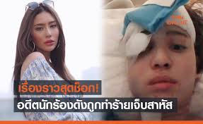 อย่างไรก็ตาม แฟนๆ ก็ยังคงแห่ให้กำลังใจ อดีตนักร้องสาว มิล่า จามิล่า พันธ์พินิจ จาก กามิกาเซ่ เจ้าของเพลงดัง ปากดี ขี้เหงา. Emosgbpsihrhnm