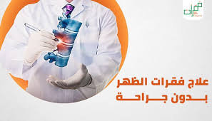 علاج فقرات الظهر بدون جراحة