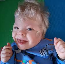 Dad's message of hope over son's rare condition that's left him unable to  crawl