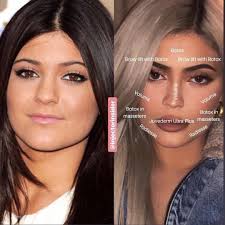 Best Of Cosmetic Dermatology On Instagram This Is How Would We Recreate Kylie S Look What Do You Think Do You Agree In Addition To What S Mentioned In Celebrity
