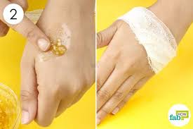 Half of all colds are viral, now we know it kills bacteria, but can a viral infection be killed (on hands) with sanitizer? How To Get Rid Of Ringworm Kill The Infection With Home Remedies