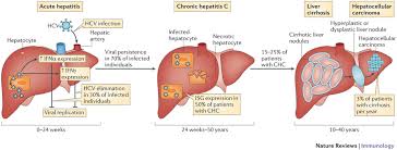 Image result for The History of Hepatitis C