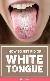 A Coated Tongue Is A Sign Of A Malfunctioning Liver And Or Poor Digestion One Must Clean Their Tongue Regularly To S Tongue Health Healthy Tongue White Tongue