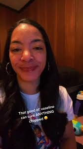 I remember having that red ring around my upper lip as a kid and my dad  ALWAYS had Vaseline and it ALWAYS got better within an hour 🥰 such relief  😂 #chappedlips #vaseline #cureseverything