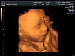 3d Ultraschall In Der 26 Ssw Baby Youtube