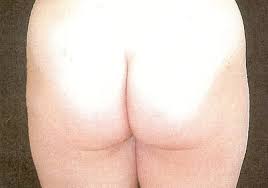 Liposuctie In Belgie Abc Clinic