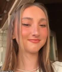 I was bullied for looking like a squirrel so I underwent $200k surgery to  change my jaw