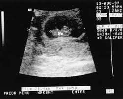 Us obstetric nuchal dating scan. Diagnostic Obstetric Ultrasound Glowm