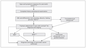 How is pancreatic cancer treated? Diagnosis And Management Of Pancreatic Cancer Cmaj