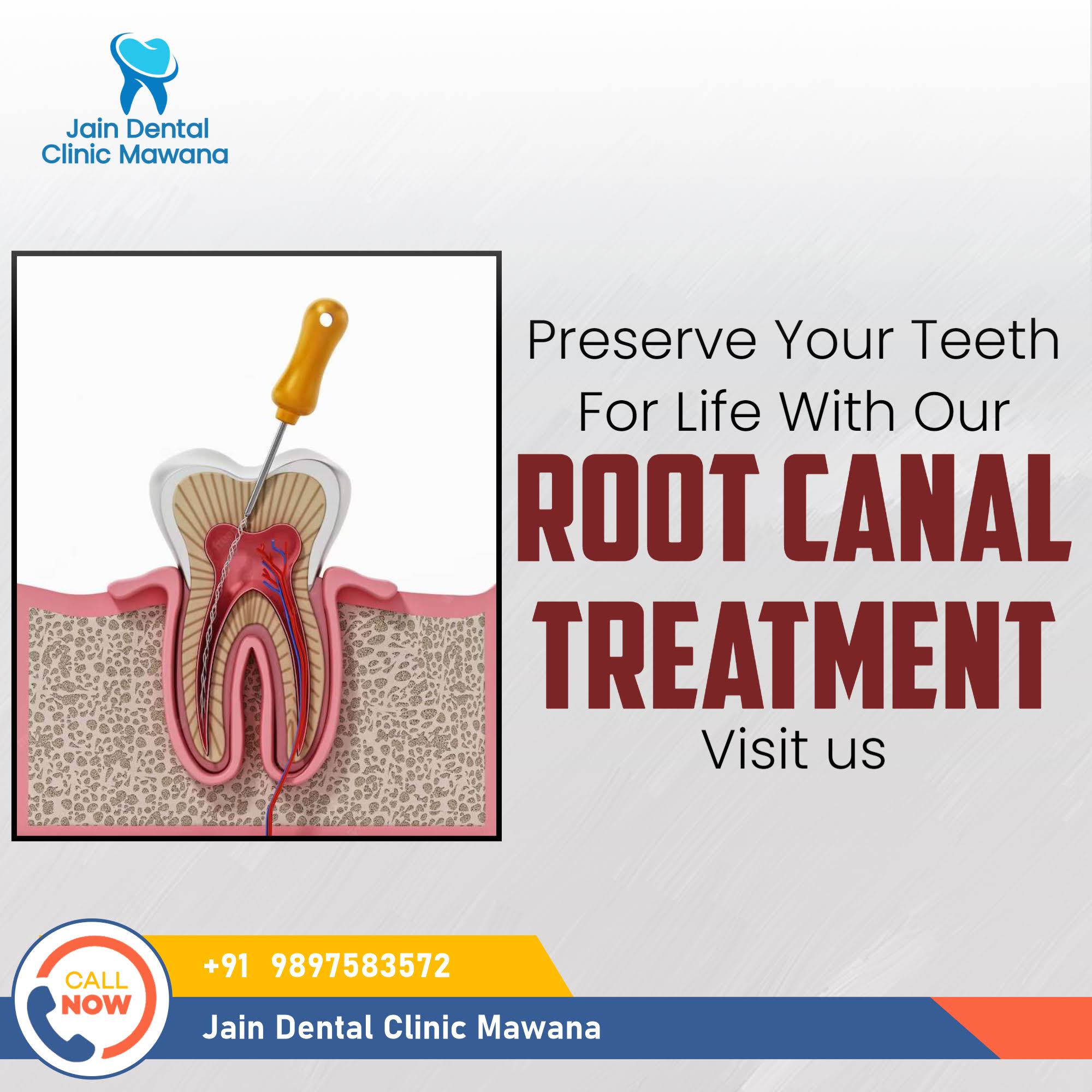 Root Canal treatment product image