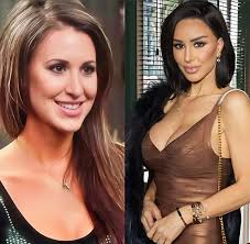 90 day fiance star post-surgery transformation