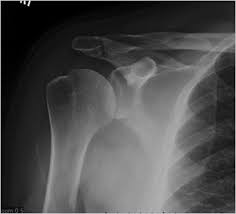 Image result for Shoulder Imaging