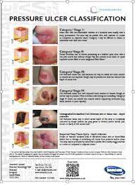 invacare think pressure care medical surgical nursing surgical nursing pressure ulcer