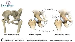 Pin On Orthopaedics