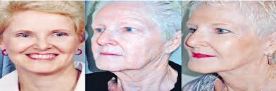 Wife seeks to join spouse