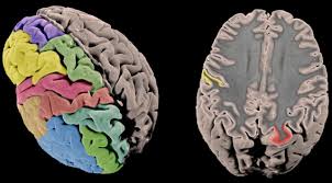 Every time you look at a picture you'll see the same images and colors. First Genetic Map Of The Cerebral Cortex Produced In Collaborative Effort