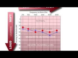 How To Read An Audiogram Youtube