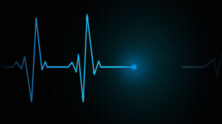 Flatliners' still have heartbeats left. But death comes within 5 minutes. |  Live Science