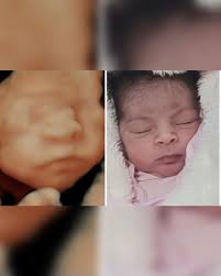 Dra. Elise Werner• Ultrassom na gestação (@dra.elisewerneraguiar) •  Instagram photos and videos