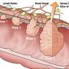 Ignoring symptoms may allow the cancer to grow to a more advanced stage and lower your chance for successful treatment. Https Encrypted Tbn0 Gstatic Com Images Q Tbn And9gctjbw5s5cjyagpnjmuabed 2m6yo Kuw5qlxyniujw Usqp Cau