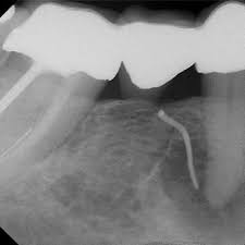 We did not find results for: Pdf Identify And Define All Diagnostic Terms For Periapical Periradicular Health And Disease States