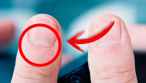 Manchas blancas en las uñas. Tienes Medias Lunas Blancas En Tus Unas Te Sorprendera Saber Su Real Significado Aweita La Republica