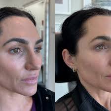 TOP 10 BEST Diamond Peel in Houston, TX