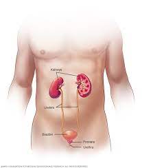 In the united states, where bladder cancer is the sixth most common cancer type diagnosed, it is estimated that approximately 81,000 new cases and 18,000 related deaths occur annually. Bladder Cancer Symptoms And Causes Mayo Clinic