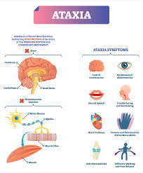 Image result for Ataxia