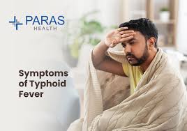 Image result for Typhoid Fever